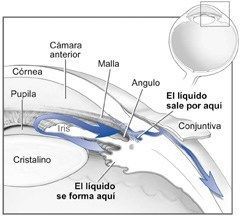 Glaucoma.Tratamiento, clasificación y video glaucoma opnerve Glaucoma.Tratamiento, clasificación y video