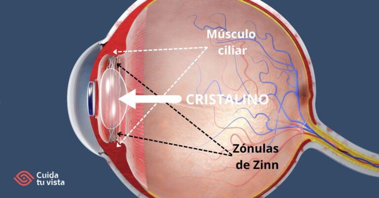 Cristalino Del Ojo Qu Es Y Cu L Es Su Funci N