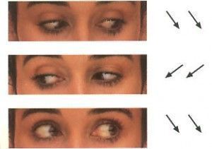 oculareslaterales