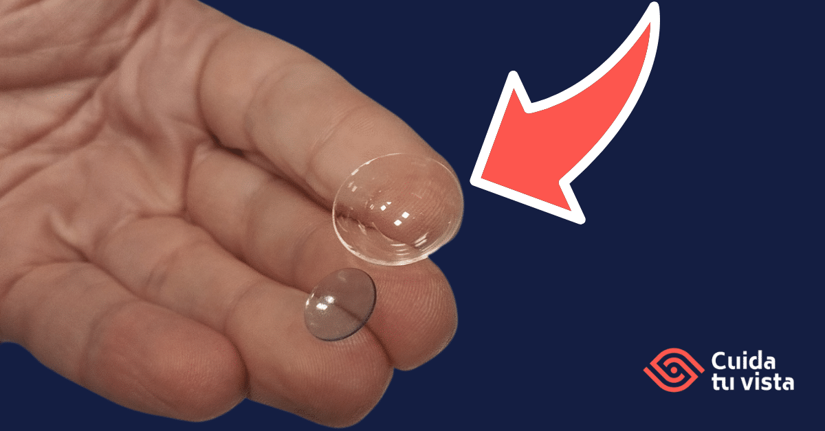 lentillas esclerales