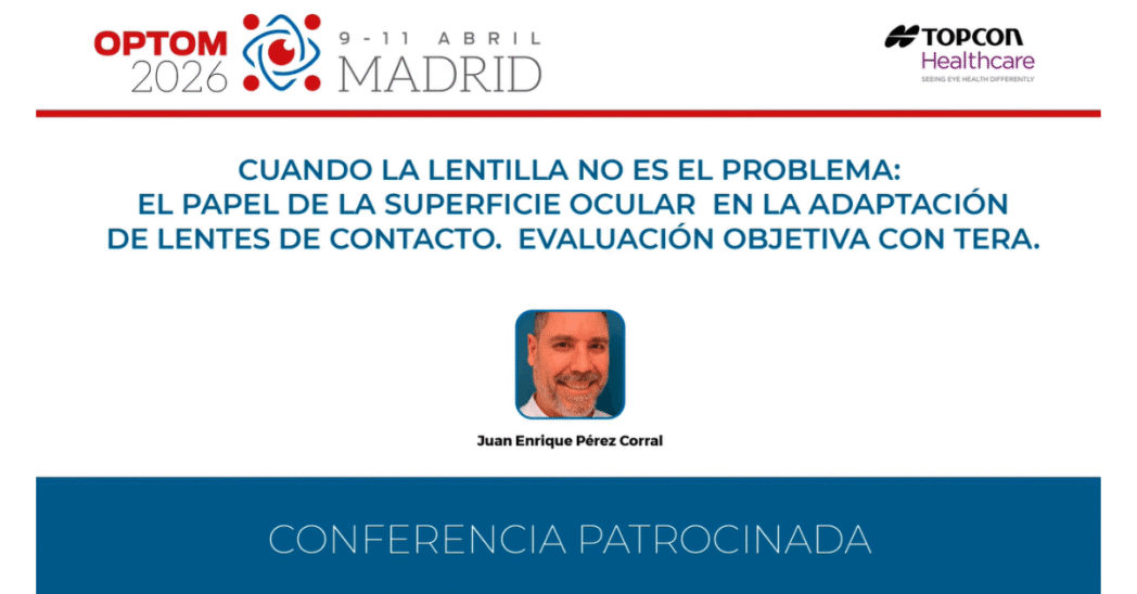conferencia patrocinada topcon superficie ocular tera